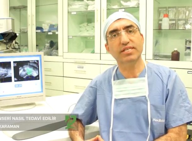 Prostat Kanseri Nasıl Tedavi Edilir