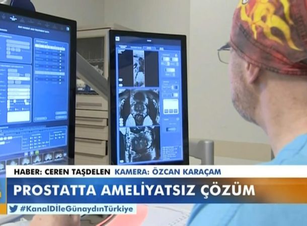 Prostat Kanseri’nde HIFU ile Fokal Terapi