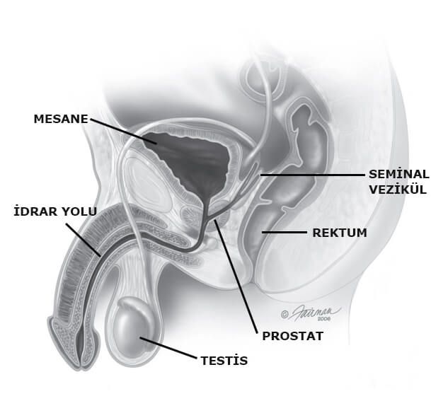 Prostat Şeması